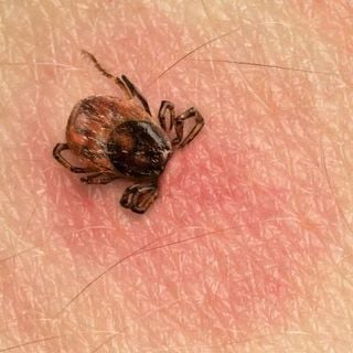 Lyme Disease